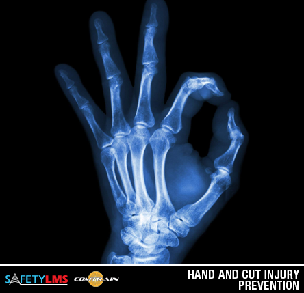 Hand & Cut Injury Prevention